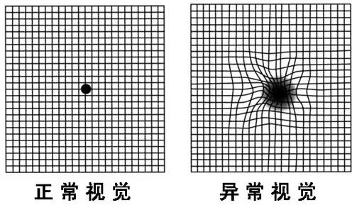 Led照明中蓝光危害，尤其是对儿童。